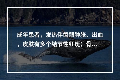 成年患者，发热伴齿龈肿胀、出血，皮肤有多个结节性红斑；骨髓中