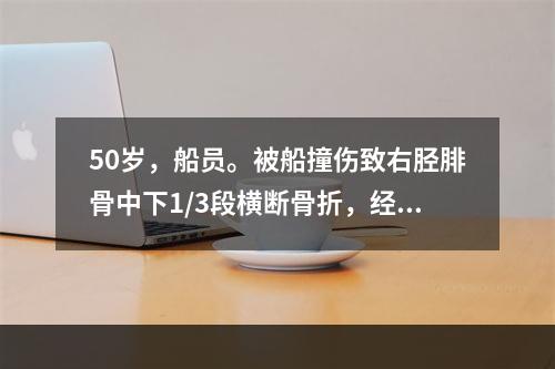 50岁，船员。被船撞伤致右胫腓骨中下1/3段横断骨折，经复位