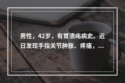 男性，42岁，有胃溃疡病史。近日发现手指关节肿胀、疼痛，早晨