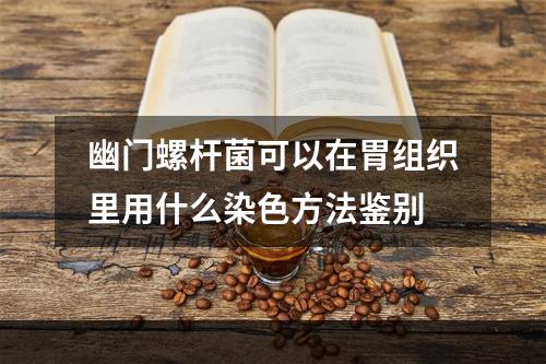 幽门螺杆菌可以在胃组织里用什么染色方法鉴别