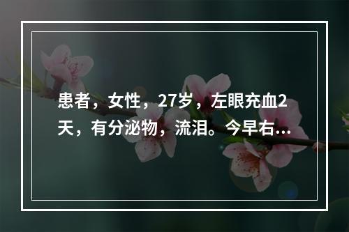 患者，女性，27岁，左眼充血2天，有分泌物，流泪。今早右眼边