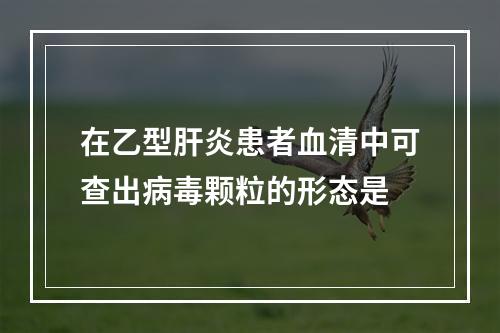 在乙型肝炎患者血清中可查出病毒颗粒的形态是