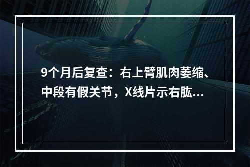 9个月后复查：右上臂肌肉萎缩、中段有假关节，X线片示右肱骨中