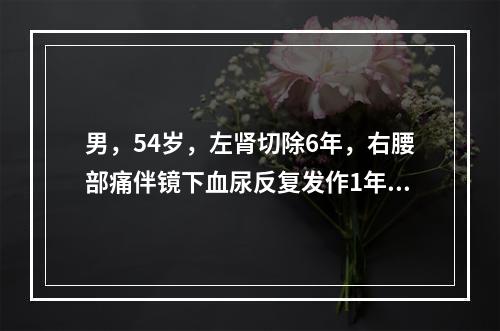 男，54岁，左肾切除6年，右腰部痛伴镜下血尿反复发作1年，近