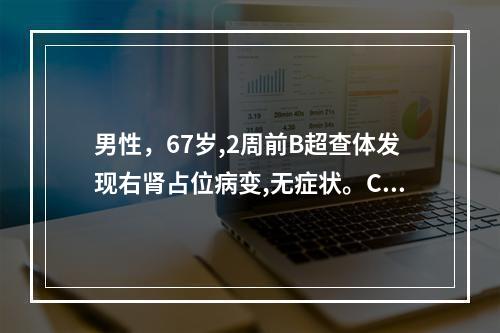 男性，67岁,2周前B超查体发现右肾占位病变,无症状。CT示