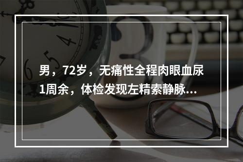 男，72岁，无痛性全程肉眼血尿1周余，体检发现左精索静脉曲张