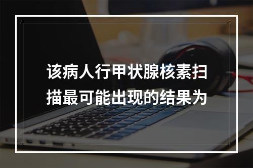 该病人行甲状腺核素扫描最可能出现的结果为