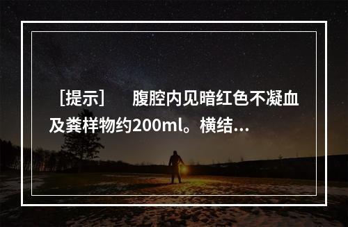 ［提示］　腹腔内见暗红色不凝血及粪样物约200ml。横结肠左