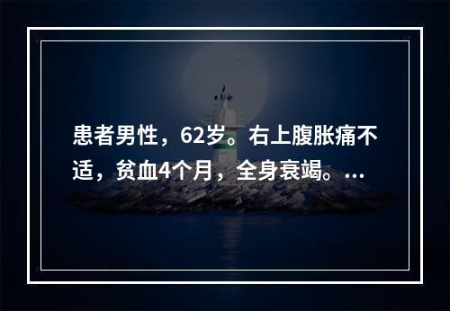 患者男性，62岁。右上腹胀痛不适，贫血4个月，全身衰竭。8小