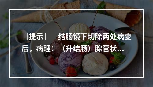 ［提示］　结肠镜下切除两处病变后，病理：（升结肠）腺管状腺瘤