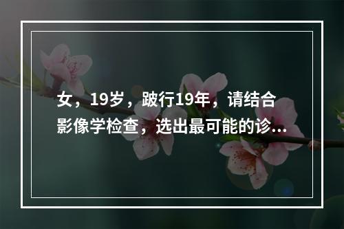 女，19岁，跛行19年，请结合影像学检查，选出最可能的诊断(