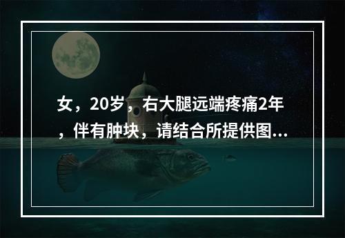 女，20岁，右大腿远端疼痛2年，伴有肿块，请结合所提供图像，