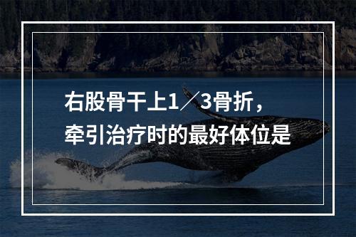 右股骨干上1／3骨折，牵引治疗时的最好体位是