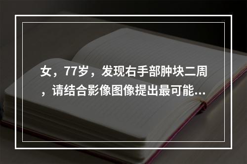 女，77岁，发现右手部肿块二周，请结合影像图像提出最可能的诊