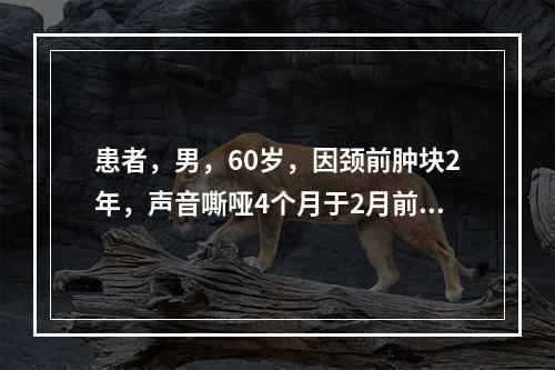 患者，男，60岁，因颈前肿块2年，声音嘶哑4个月于2月前行甲