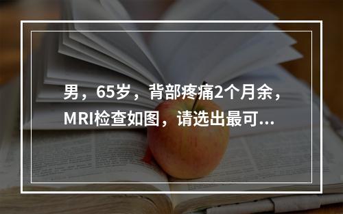 男，65岁，背部疼痛2个月余，MRI检查如图，请选出最可能的