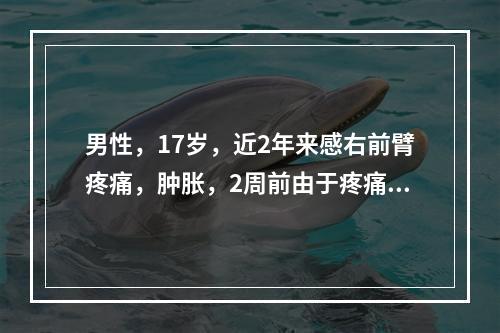 男性，17岁，近2年来感右前臂疼痛，肿胀，2周前由于疼痛加剧