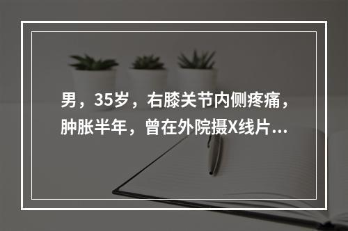 男，35岁，右膝关节内侧疼痛，肿胀半年，曾在外院摄X线片，见