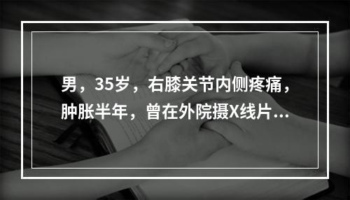 男，35岁，右膝关节内侧疼痛，肿胀半年，曾在外院摄X线片，见