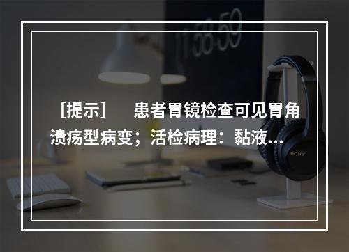 ［提示］　患者胃镜检查可见胃角溃疡型病变；活检病理：黏液细胞