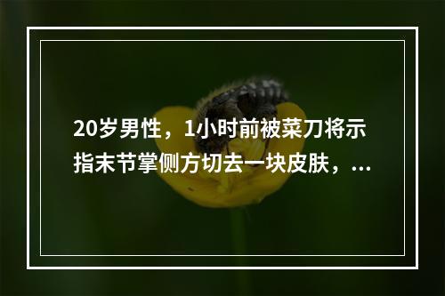 20岁男性，1小时前被菜刀将示指末节掌侧方切去一块皮肤，约1