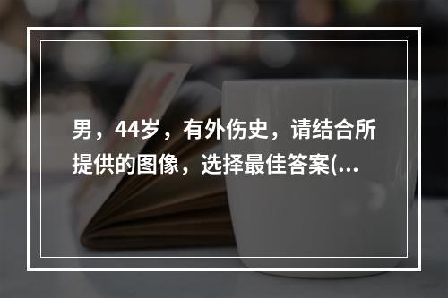 男，44岁，有外伤史，请结合所提供的图像，选择最佳答案()