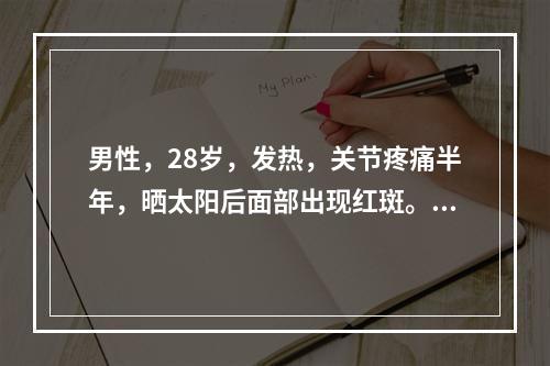 男性，28岁，发热，关节疼痛半年，晒太阳后面部出现红斑。查体