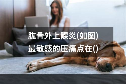 肱骨外上髁炎(如图)最敏感的压痛点在()