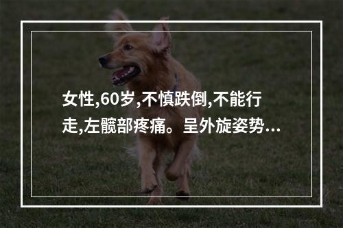 女性,60岁,不慎跌倒,不能行走,左髋部疼痛。呈外旋姿势。检