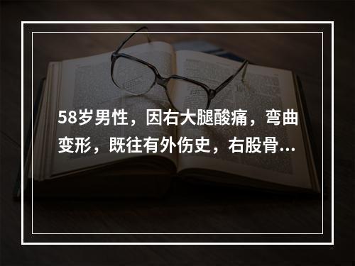 58岁男性，因右大腿酸痛，弯曲变形，既往有外伤史，右股骨摄片