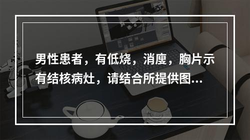 男性患者，有低烧，消廋，胸片示有结核病灶，请结合所提供图像，