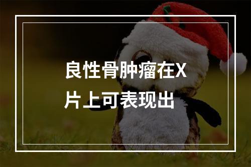 良性骨肿瘤在X片上可表现出