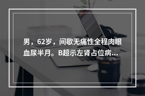 男，62岁，间歇无痛性全程肉眼血尿半月。B超示左肾占位病变，