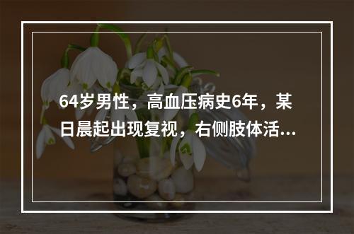 64岁男性，高血压病史6年，某日晨起出现复视，右侧肢体活动不