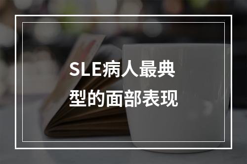 SLE病人最典型的面部表现