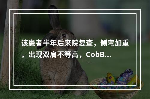 该患者半年后来院复查，侧弯加重，出现双肩不等高，CobB角为