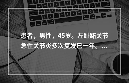 患者，男性，45岁。左趾跖关节急性关节炎多次复发已一年。化验