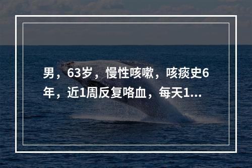 男，63岁，慢性咳嗽，咳痰史6年，近1周反复咯血，每天100