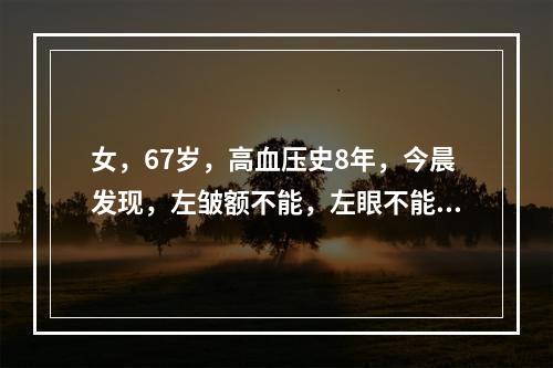 女，67岁，高血压史8年，今晨发现，左皱额不能，左眼不能闭合