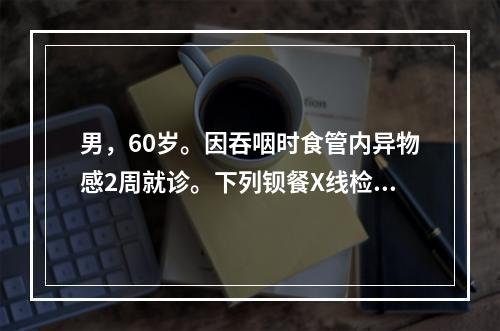 男，60岁。因吞咽时食管内异物感2周就诊。下列钡餐X线检查表