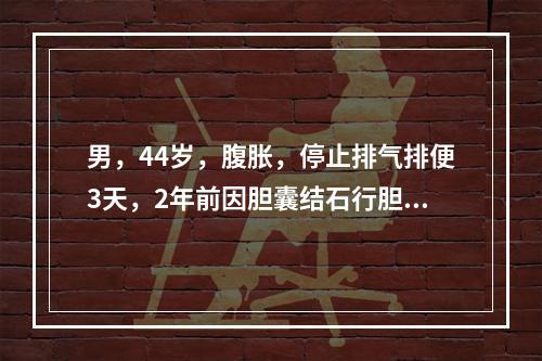 男，44岁，腹胀，停止排气排便3天，2年前因胆囊结石行胆囊切