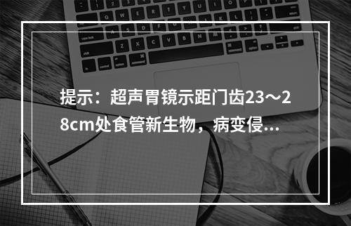 提示：超声胃镜示距门齿23～28cm处食管新生物，病变侵及食