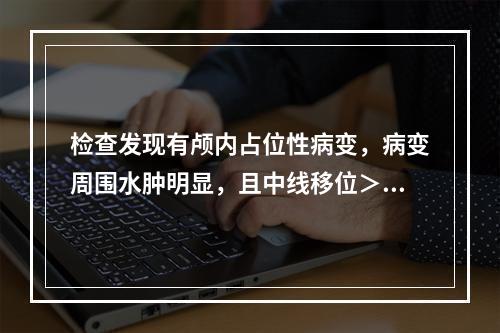 检查发现有颅内占位性病变，病变周围水肿明显，且中线移位＞O.