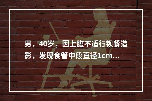 男，40岁，因上腹不适行钡餐造影，发现食管中段直径1cm憩室