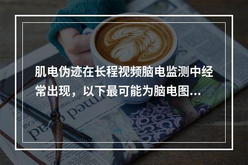 肌电伪迹在长程视频脑电监测中经常出现，以下最可能为脑电图上肌