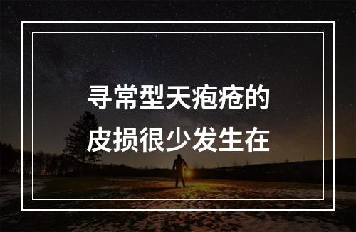 寻常型天疱疮的皮损很少发生在