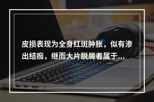 皮损表现为全身红斑肿胀，似有渗出结痂，继而大片脱屑者属于()