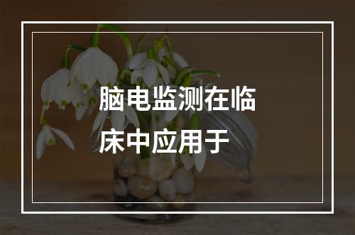 脑电监测在临床中应用于