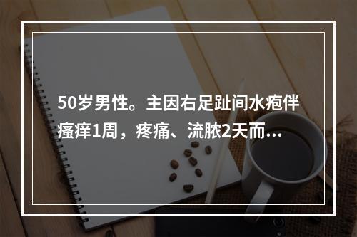 50岁男性。主因右足趾间水疱伴瘙痒1周，疼痛、流脓2天而就诊