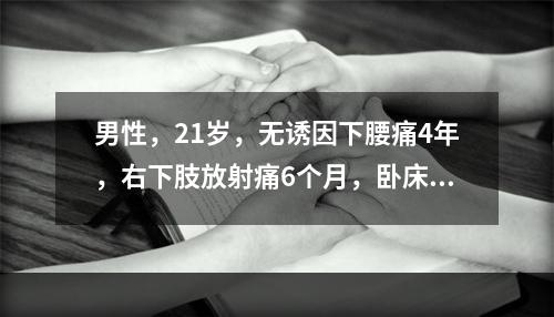 男性，21岁，无诱因下腰痛4年，右下肢放射痛6个月，卧床好转